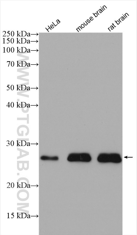 LYPLA1 Antibody in Western Blot (WB)