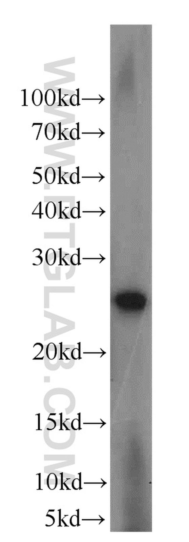 LYPLA1 Antibody in Western Blot (WB)