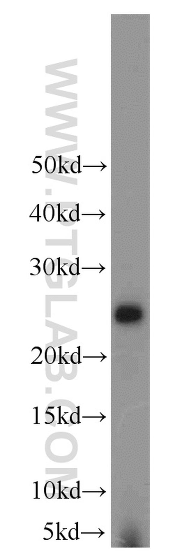 LYPLA1 Antibody in Western Blot (WB)