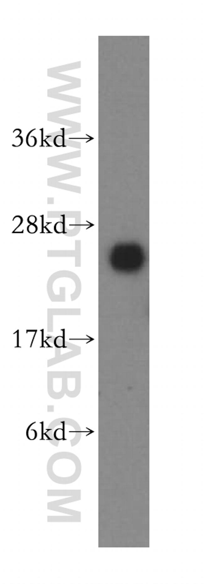 LYPLA1 Antibody in Western Blot (WB)