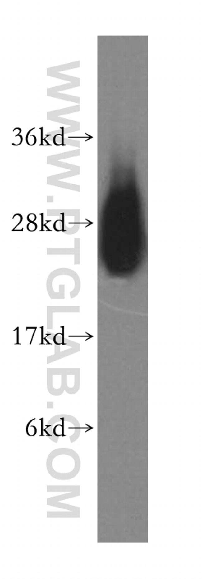 LYPLA1 Antibody in Western Blot (WB)