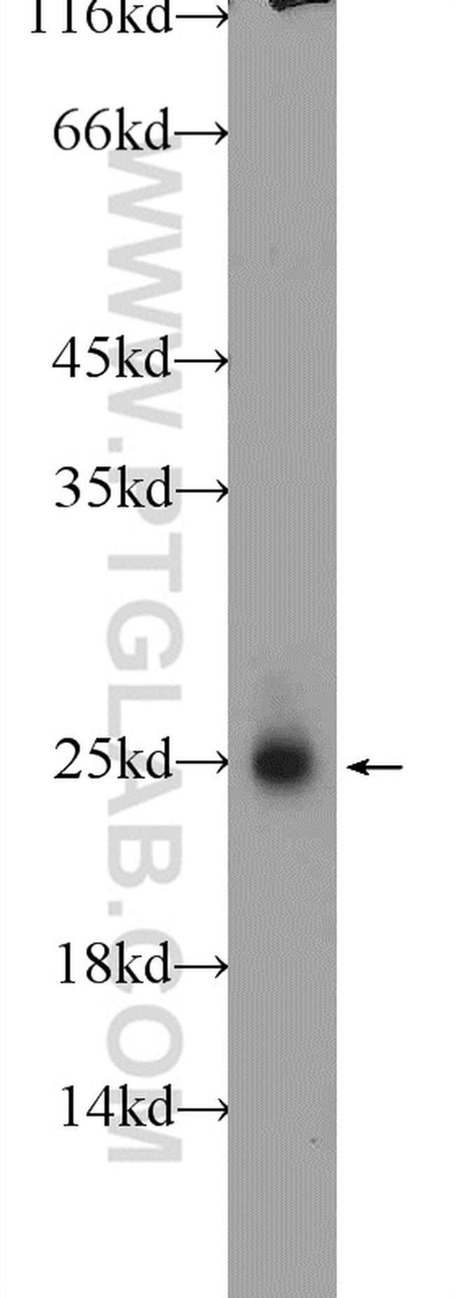 LYPLA1 Antibody in Western Blot (WB)