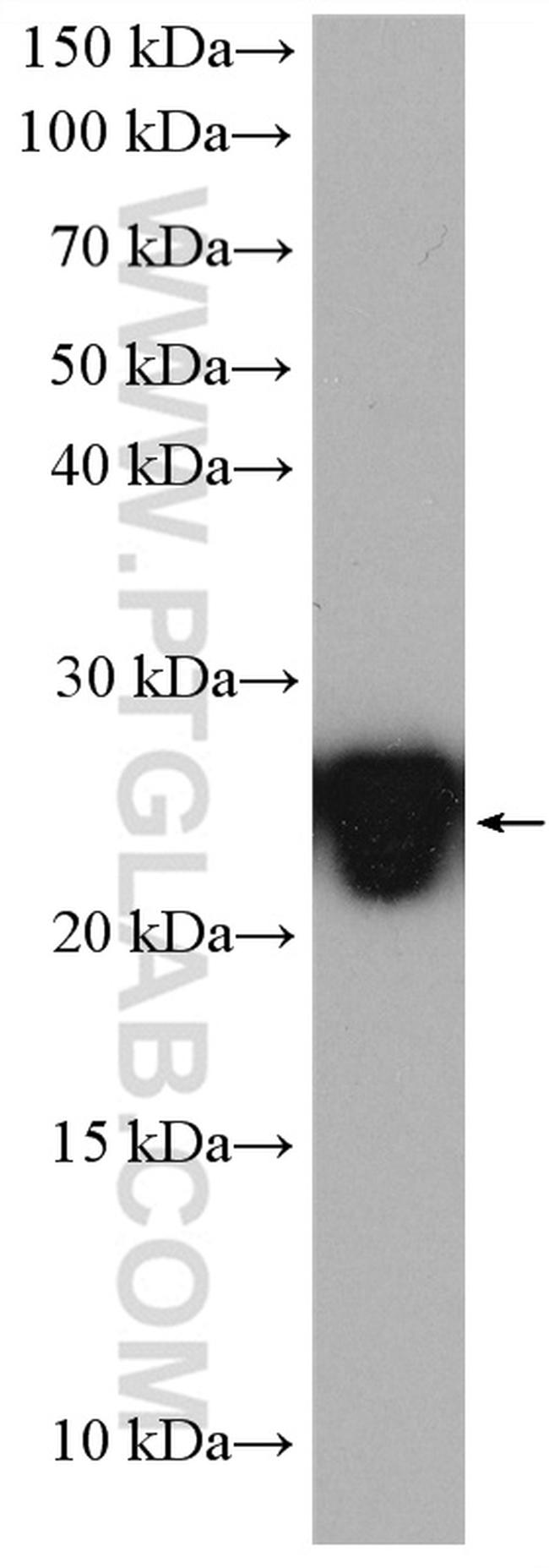 LYPLA1 Antibody in Western Blot (WB)