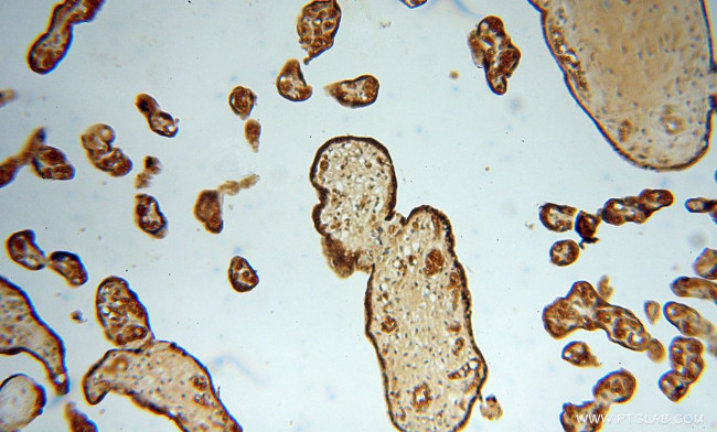 PDCL Antibody in Immunohistochemistry (Paraffin) (IHC (P))