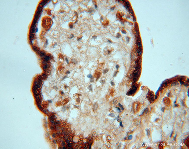 PDCL Antibody in Immunohistochemistry (Paraffin) (IHC (P))