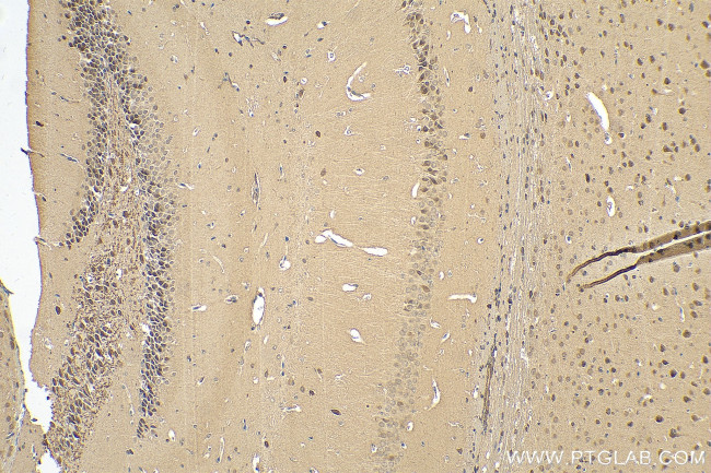 PDCL Antibody in Immunohistochemistry (Paraffin) (IHC (P))