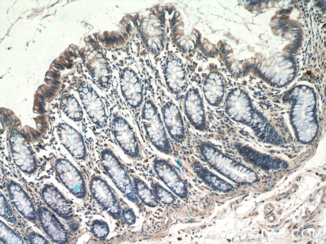 TSPAN1 Antibody in Immunohistochemistry (Paraffin) (IHC (P))