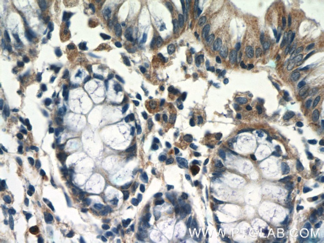 TSPAN1 Antibody in Immunohistochemistry (Paraffin) (IHC (P))