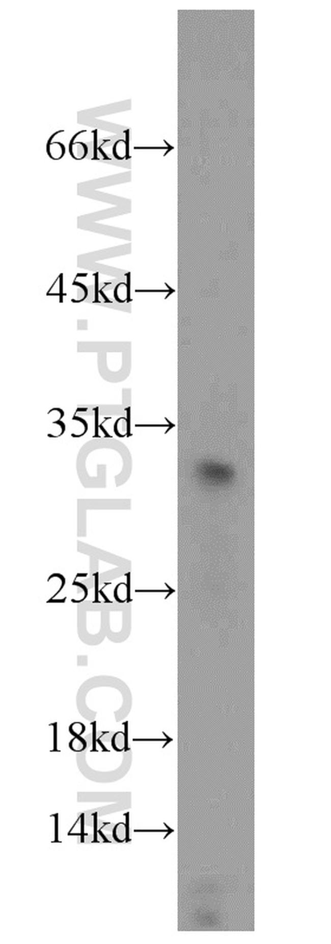 TSPAN1 Antibody in Western Blot (WB)