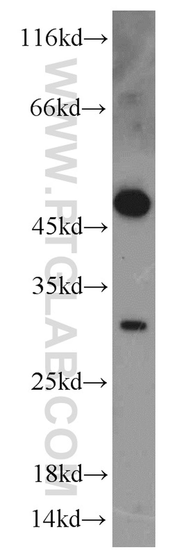 TSPAN1 Antibody in Western Blot (WB)