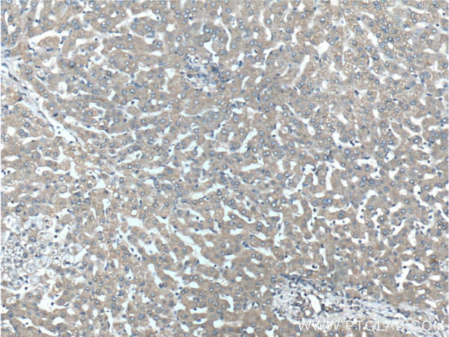 NMD3 Antibody in Immunohistochemistry (Paraffin) (IHC (P))