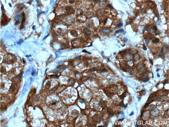 NMD3 Antibody in Immunohistochemistry (Paraffin) (IHC (P))