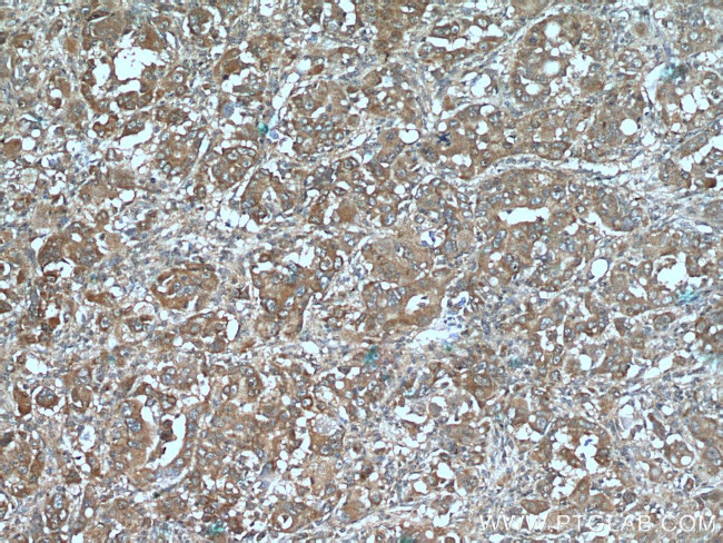 CYP39A1 Antibody in Immunohistochemistry (Paraffin) (IHC (P))