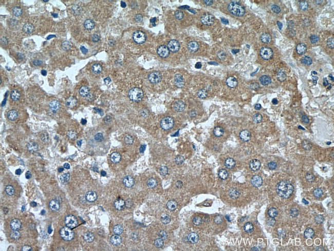 CYP39A1 Antibody in Immunohistochemistry (Paraffin) (IHC (P))