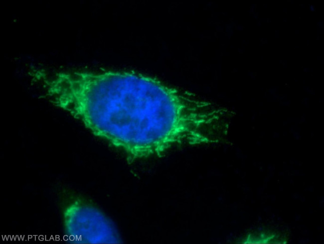 PMPCB Antibody in Immunocytochemistry (ICC/IF)