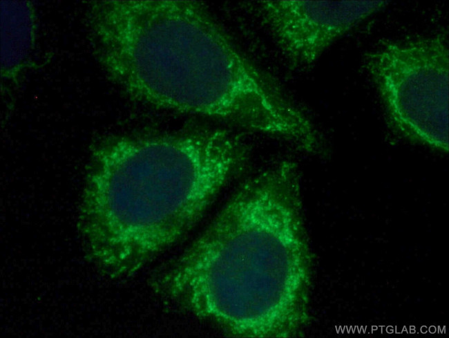 PMPCB Antibody in Immunocytochemistry (ICC/IF)