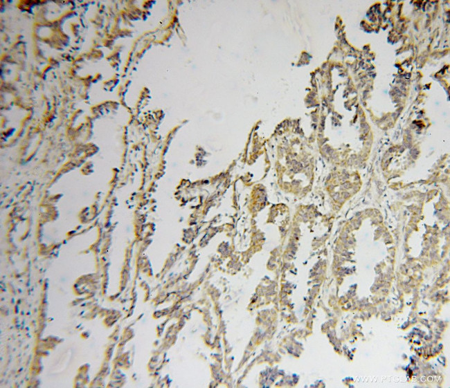 PMPCB Antibody in Immunohistochemistry (Paraffin) (IHC (P))