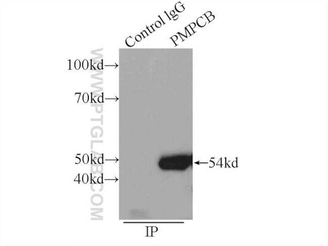 PMPCB Antibody in Immunoprecipitation (IP)