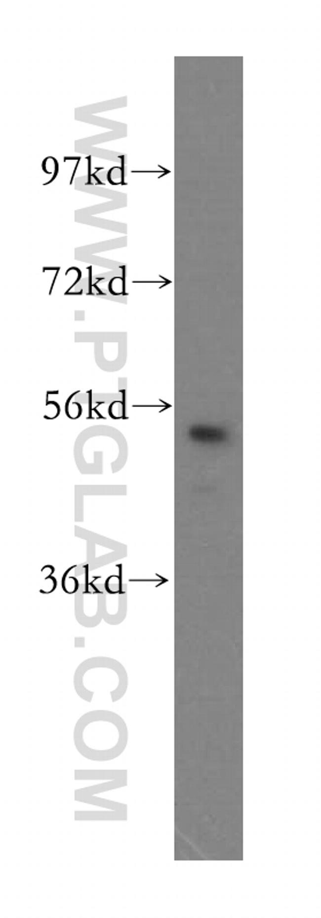 PMPCB Antibody in Western Blot (WB)