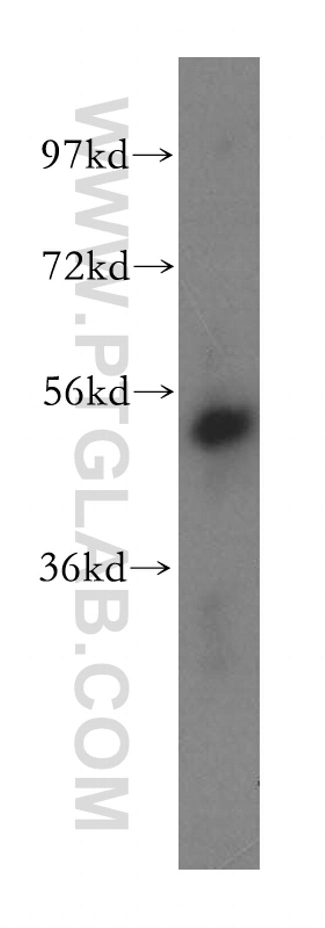 PMPCB Antibody in Western Blot (WB)