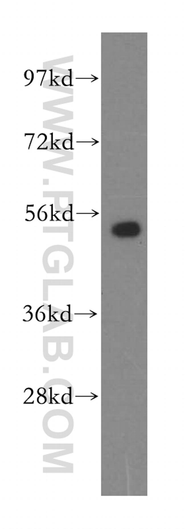 PMPCB Antibody in Western Blot (WB)