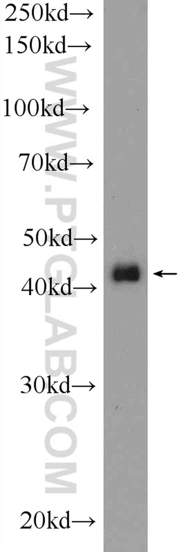 PMPCB Antibody in Western Blot (WB)