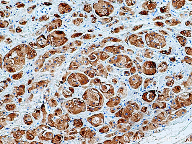 GCDFP-15/PIP Antibody in Immunohistochemistry (Paraffin) (IHC (P))