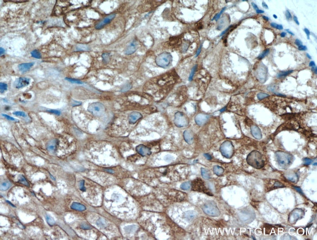 GCDFP-15/PIP Antibody in Immunohistochemistry (Paraffin) (IHC (P))