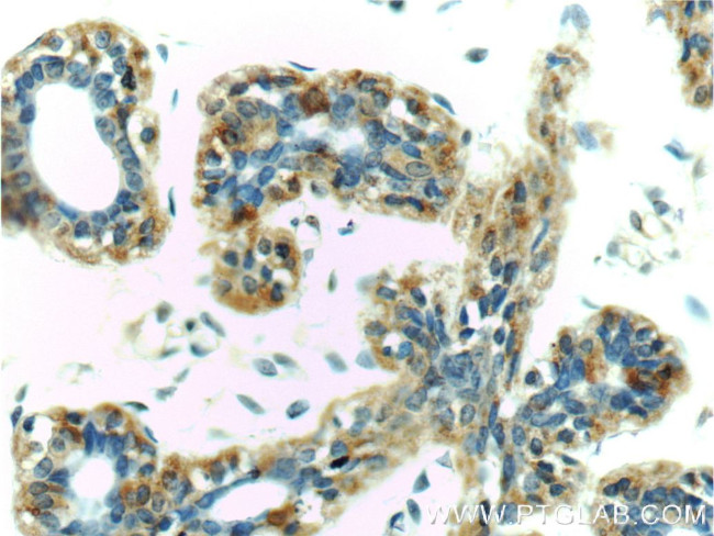 GCDFP-15/PIP Antibody in Immunohistochemistry (Paraffin) (IHC (P))