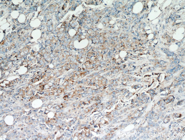 GCDFP-15/PIP Antibody in Immunohistochemistry (Paraffin) (IHC (P))