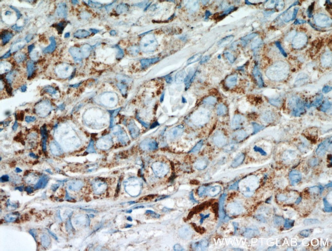 GCDFP-15/PIP Antibody in Immunohistochemistry (Paraffin) (IHC (P))