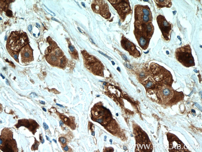 GCDFP-15/PIP Antibody in Immunohistochemistry (Paraffin) (IHC (P))