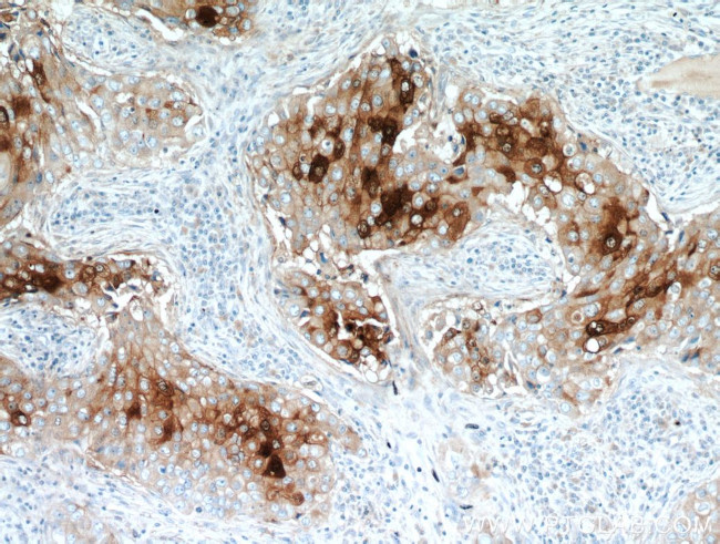 GCDFP-15/PIP Antibody in Immunohistochemistry (Paraffin) (IHC (P))