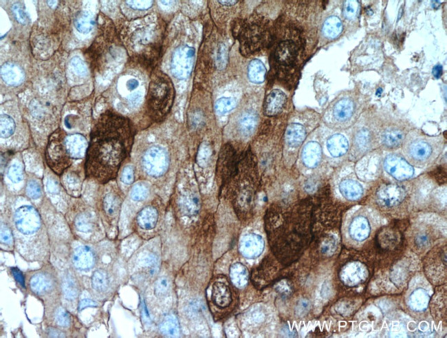 GCDFP-15/PIP Antibody in Immunohistochemistry (Paraffin) (IHC (P))