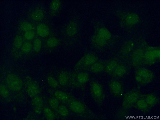 PIAS2 Antibody in Immunocytochemistry (ICC/IF)