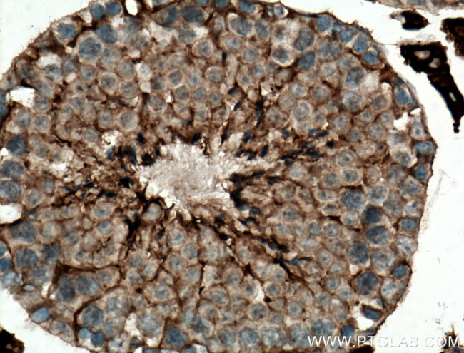 ACSBG1 Antibody in Immunohistochemistry (Paraffin) (IHC (P))