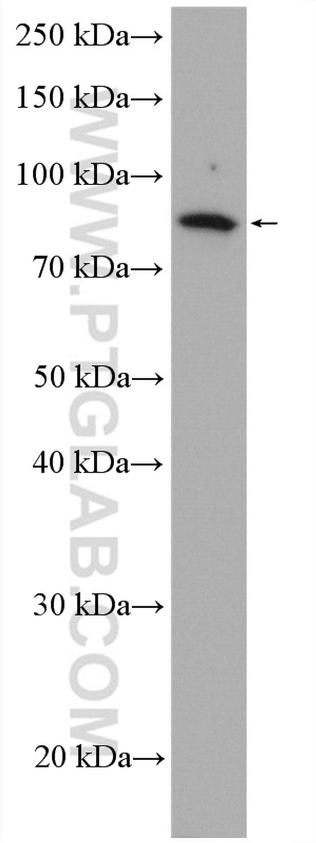 ACSBG1 Antibody in Western Blot (WB)