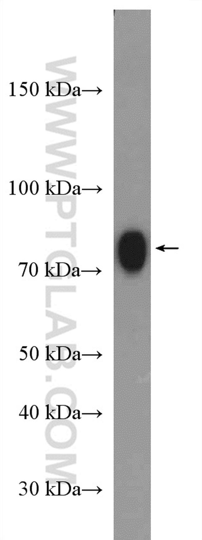 ACSBG1 Antibody in Western Blot (WB)