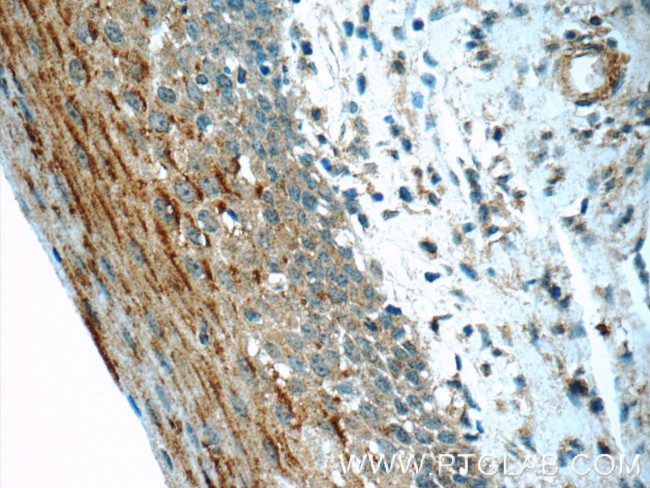 TCN1 Antibody in Immunohistochemistry (Paraffin) (IHC (P))