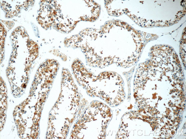 TCN1 Antibody in Immunohistochemistry (Paraffin) (IHC (P))