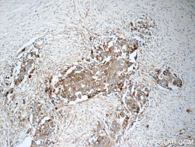 TrpRS Antibody in Immunohistochemistry (Paraffin) (IHC (P))