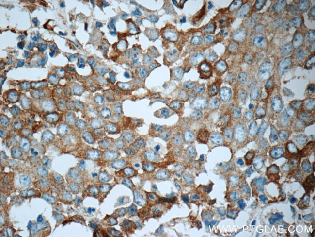 TrpRS Antibody in Immunohistochemistry (Paraffin) (IHC (P))