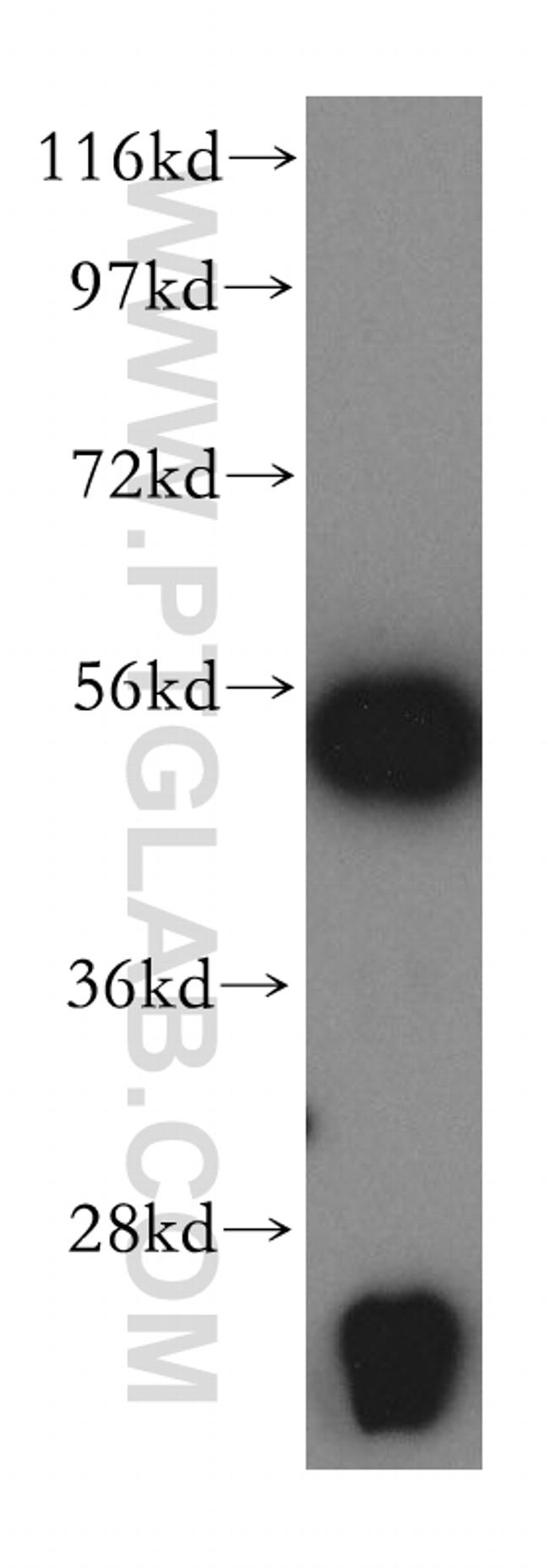 TrpRS Antibody in Western Blot (WB)