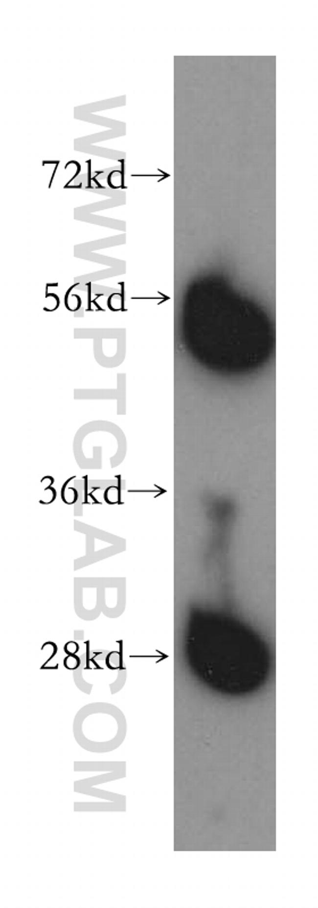 TrpRS Antibody in Western Blot (WB)