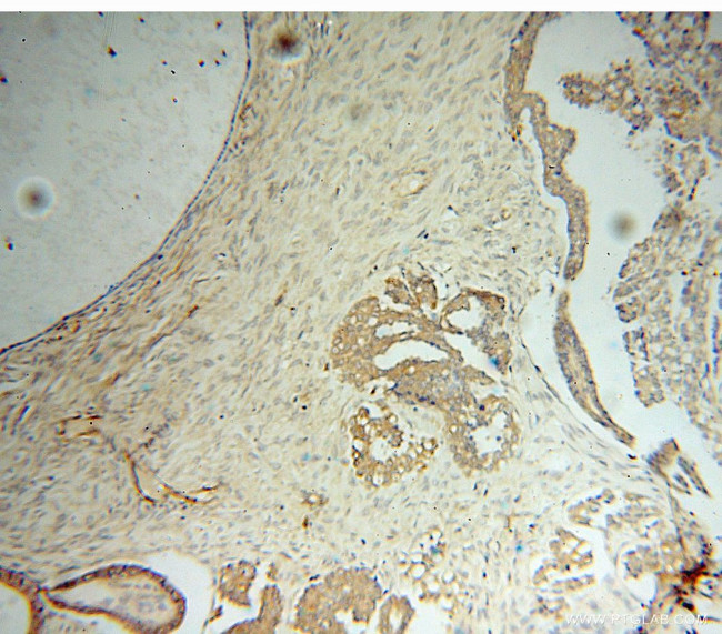 TrpRS Antibody in Immunohistochemistry (Paraffin) (IHC (P))