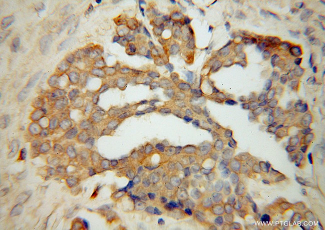 TrpRS Antibody in Immunohistochemistry (Paraffin) (IHC (P))