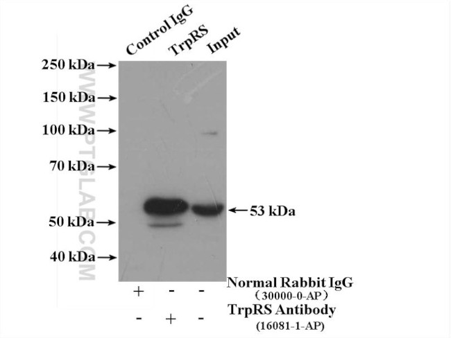 TrpRS Antibody in Immunoprecipitation (IP)