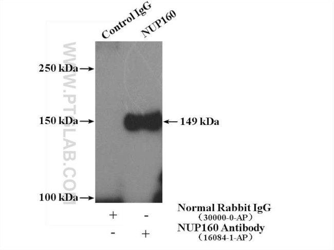 NUP160 Antibody in Immunoprecipitation (IP)