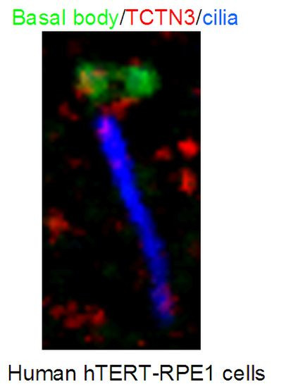 TCTN3 Antibody in Immunocytochemistry (ICC/IF)