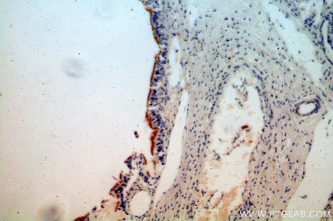 TCTN3 Antibody in Immunohistochemistry (Paraffin) (IHC (P))